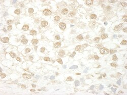 MLLT1 Antibody, Novus Biologicals 0.1mL; Unlabeled:Antibodies, Polyclonal